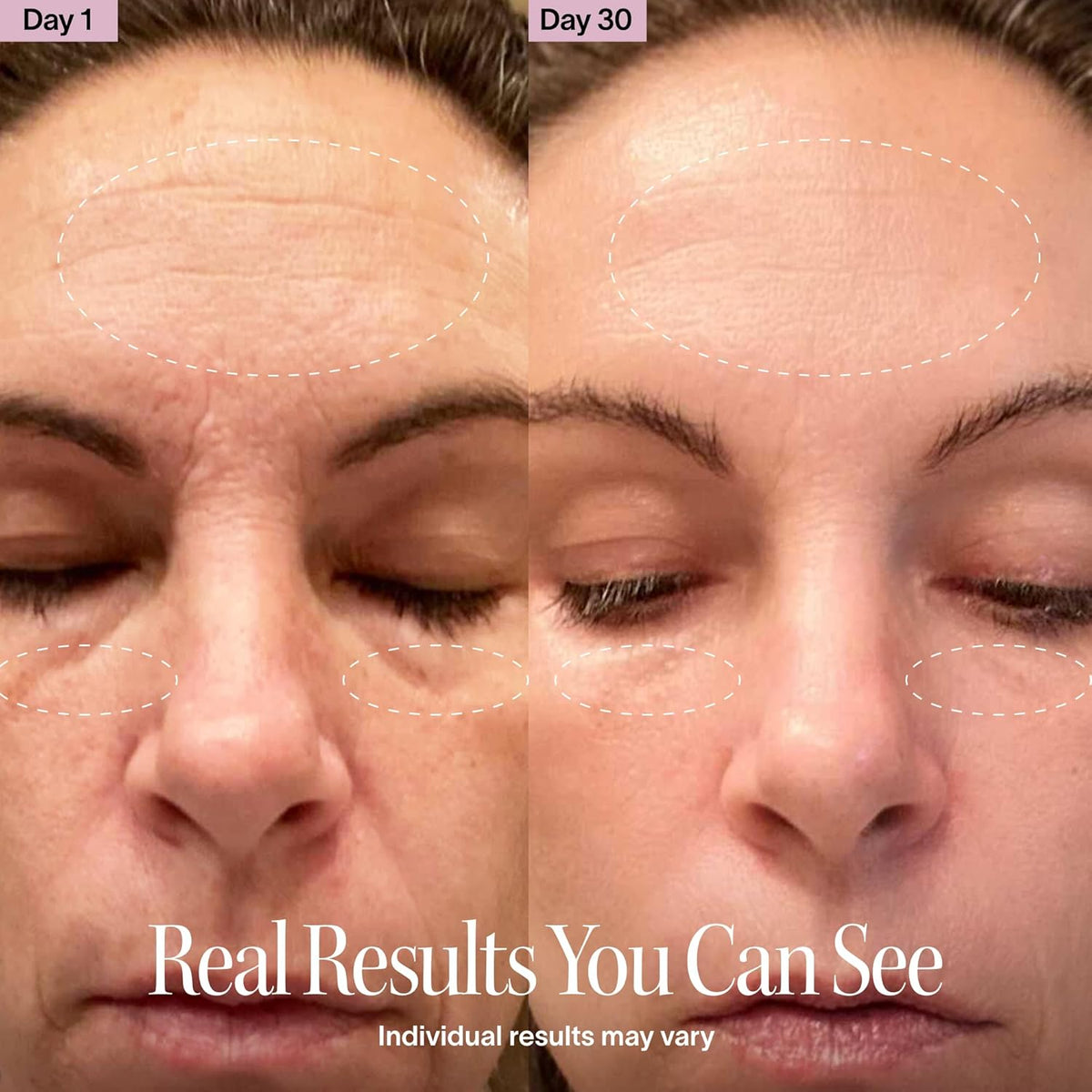 Claréa Anti-Aging Red Light Therapy Wand – 4-in-1 Anti-Aging Device for Face & Neck